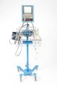 Electronic Monitors and Diagnostic Equipment
