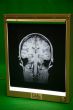 Wall mounted light box with X-ray film