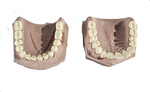 Pair Of Top And Bottom Mouth Model 