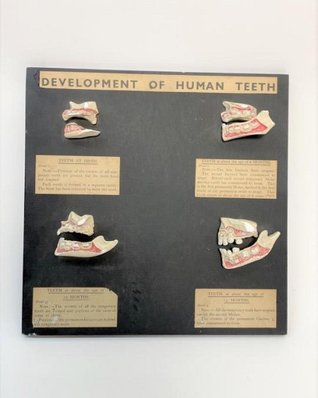 Development of human teeth