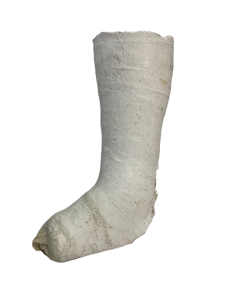 Plaster Half Leg Cast