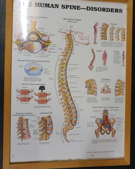 Anatomical Framed Print Human Spine