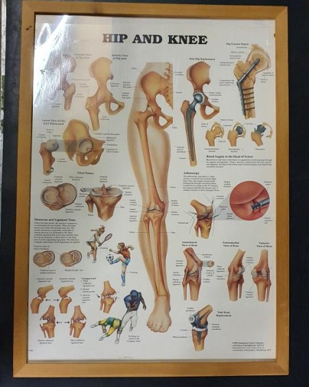 Anatomical Framed Print Hip & Knee