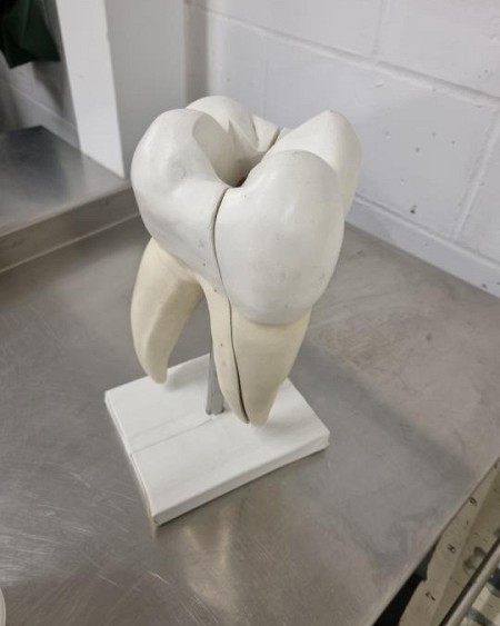 Large Tooth Model 