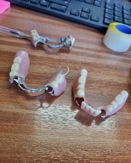 Pair of dentures 