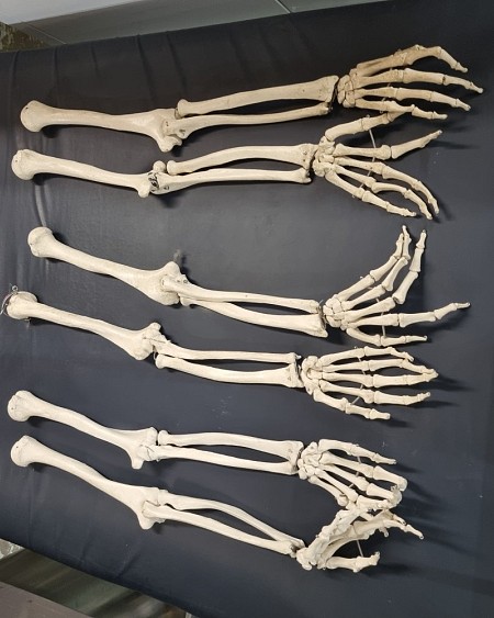 Skeleton arm