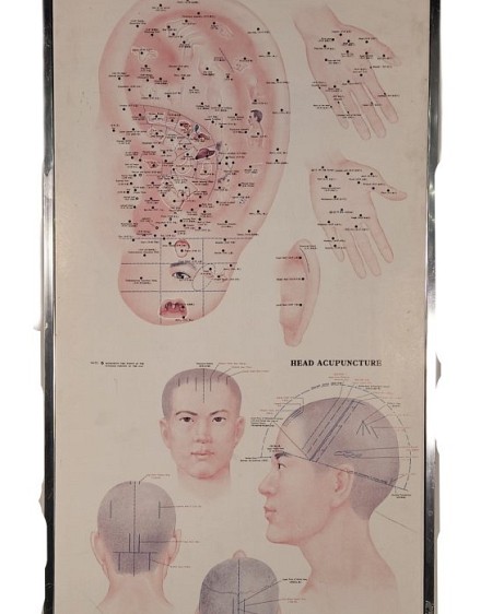 Acupuncture Chart 