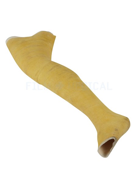 Full Leg Cast Yellow