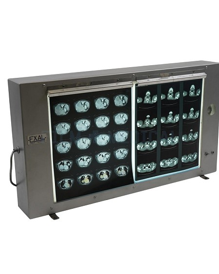 Period Double Light Box (X-Rays Priced Separately)