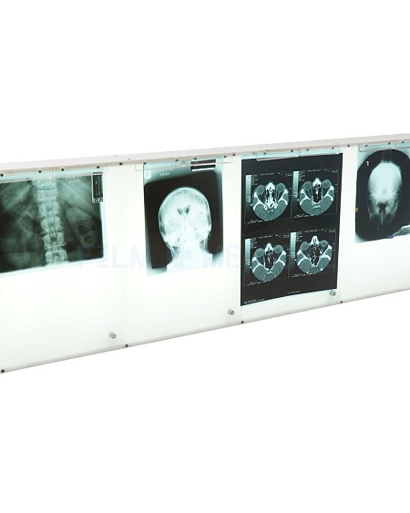 Quadruple Light Box (X-Rays Priced Separately)