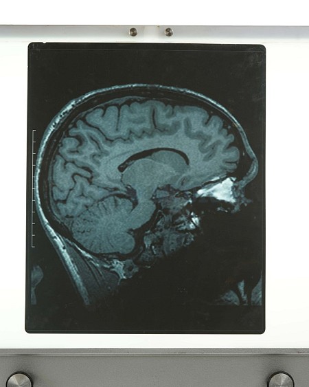 X-Ray Brain