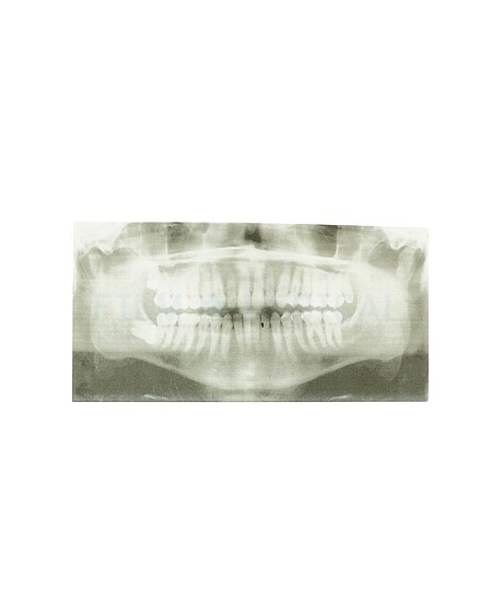 X-Ray Dental