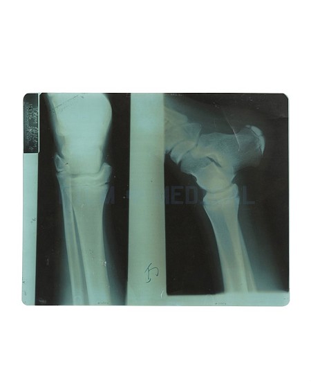 X-Ray Leg