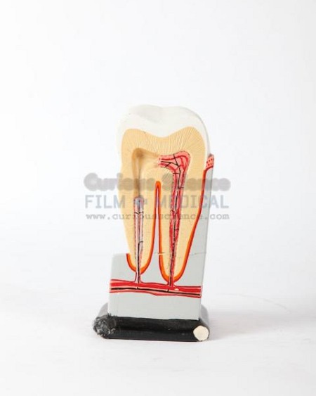 Small Dissected Molar