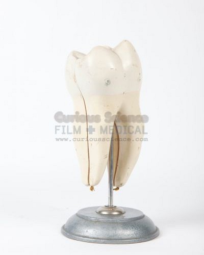 DUPLICATE Model of tooth DUPLICATE