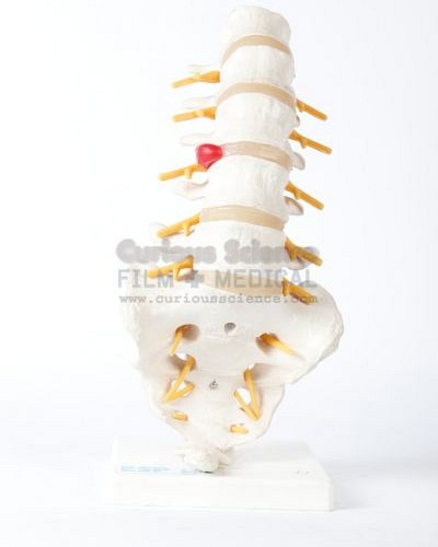 Lower Back Spinal model
