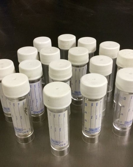 Urine sample containers