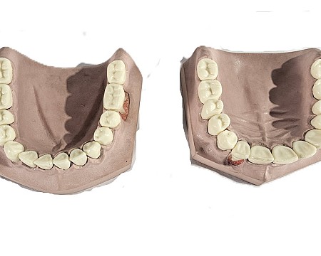 Pair Of Top And Bottom Mouth Model 