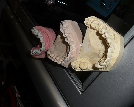 Tooth Mould