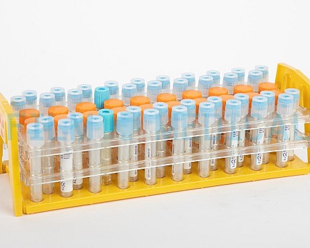 Sample Rack with Vacutainers  