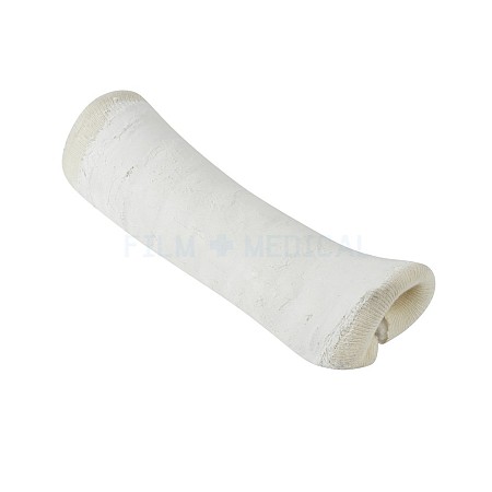 Cast Forearm White Plaster