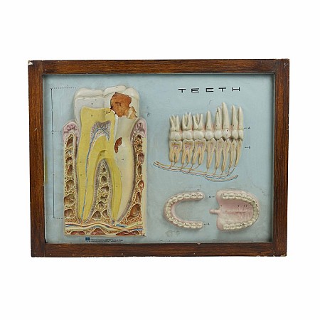 Teeth Framed 3D Picture