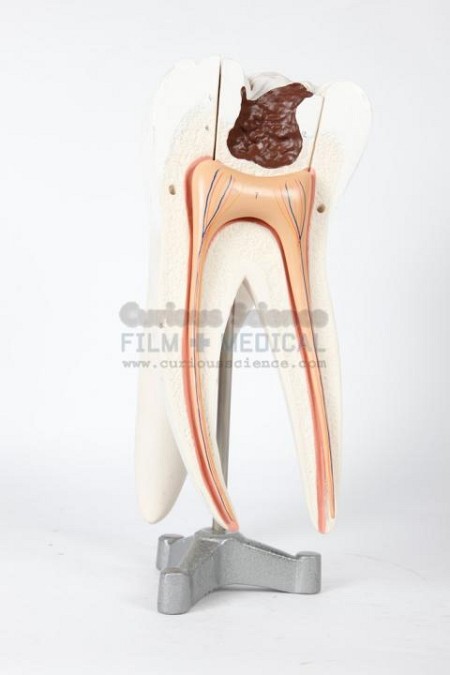 Period Large Molar 