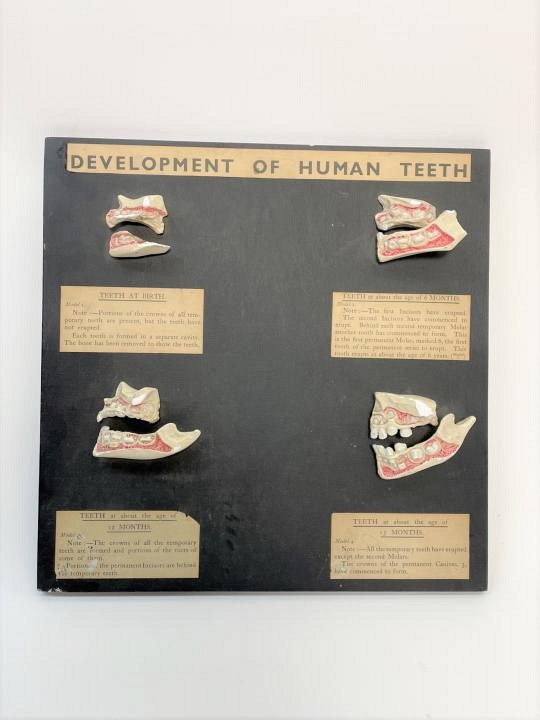 Development of human teeth