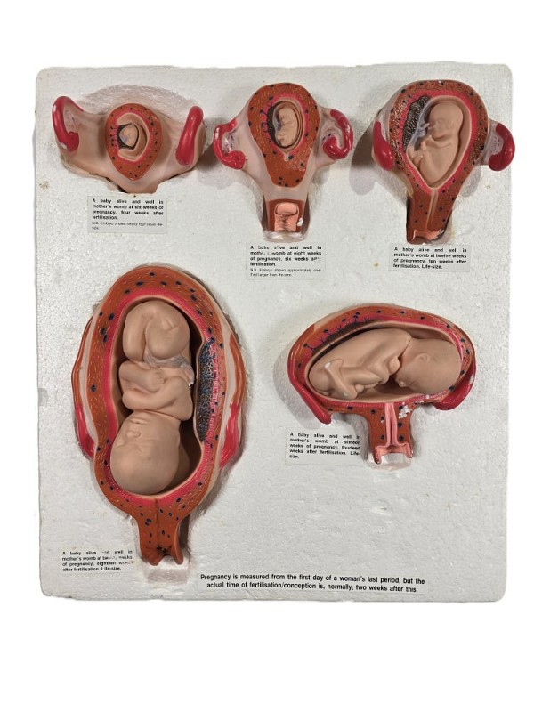 Fetus Development