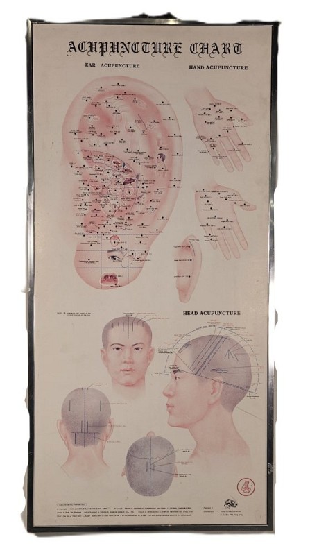 Acupuncture Chart 